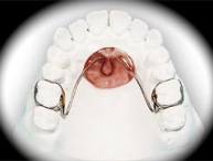 European Orthodontic Product