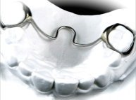 European Orthodontic Product