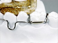 European Orthodontic Product